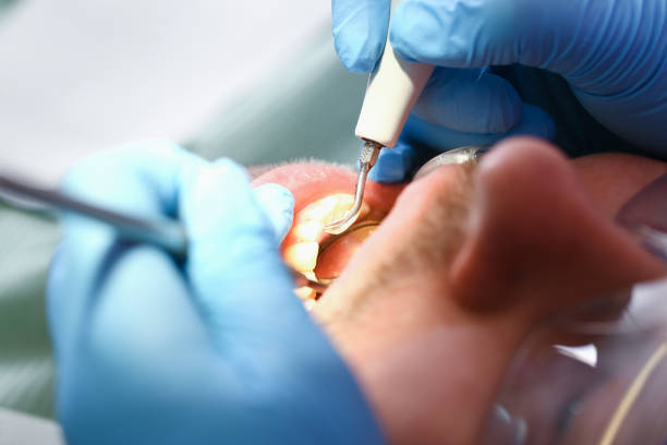 Best Mobile Emergency Dentist in Sesser, IL