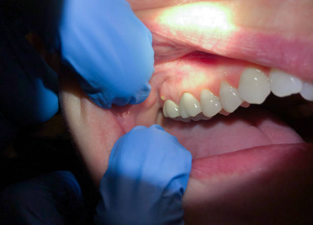 Best Pediatric Emergency Dentist in Sesser, IL